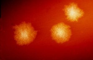 C. difficile colonies on a blood agar plate.