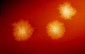 C. difficile colonies on a blood agar plate.